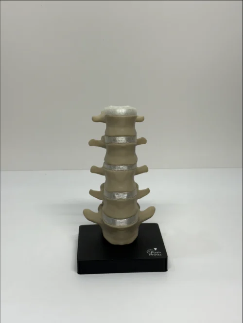 Modular Lumbar Spine